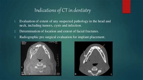 ct vs cbct|cbct scan dental code.